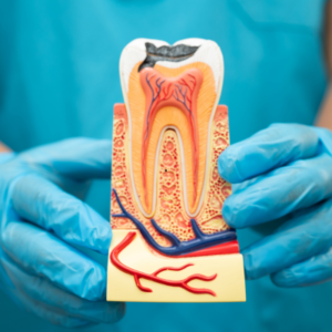Colorado Springs root canal retreatment doctor