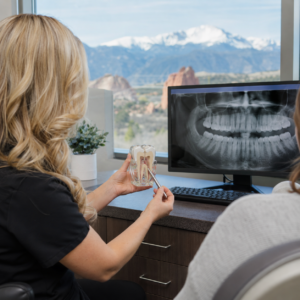 Colorado Springs cracked teeth doctor