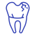 Cracked Teeth